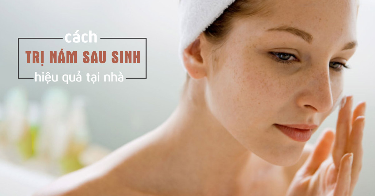 Mách nàng cách chữa nám da mặt sau sinh hiệu quả