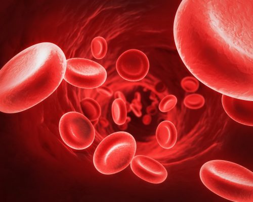 Thiếu máu là một biến chứng của bệnh u xơ tử cung