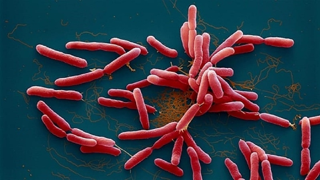 Cảnh giác với bệnh nhiễm trùng, nhiễm độc do vi khuẩn “ăn thịt người”